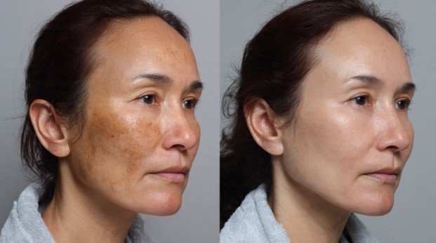 Who Gets the Best Results